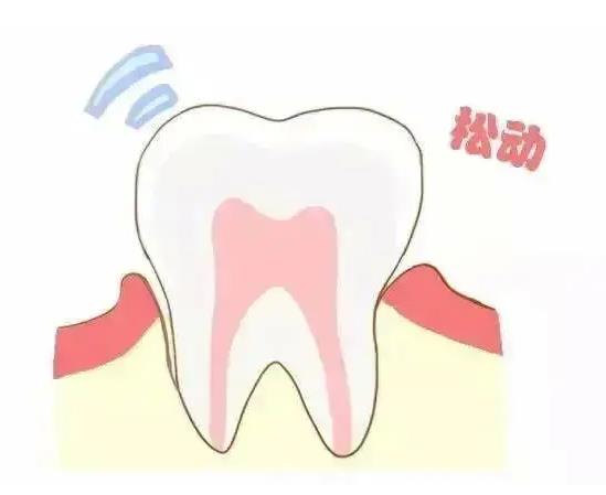 鑲牙副作用有哪些