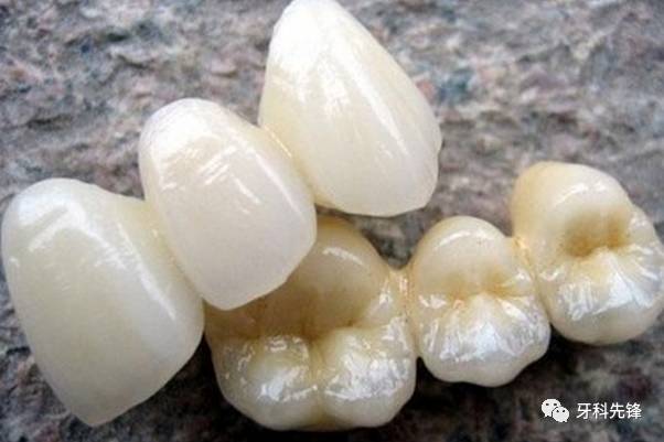 “洗牙會把牙齒洗壞？”您被騙了！