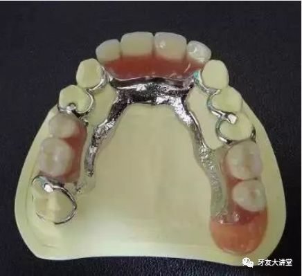 我只缺一顆牙，可以唔管佢嗎？