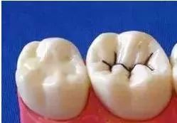 守護兒牙健康，從“齒”開始！