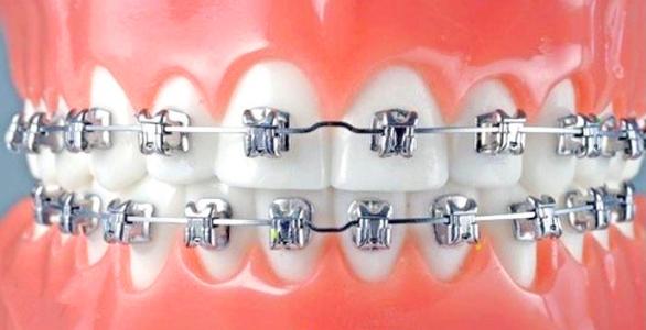 你們講嘅「拔絲爾晴」，真相原來係咁