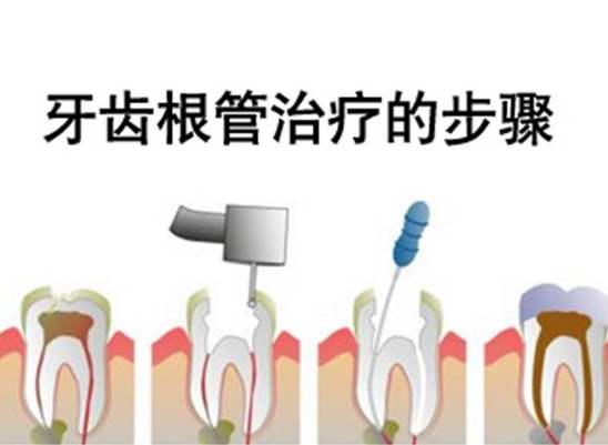 根管治療之後，戴牙套牙齒會發黑，有什麼影響