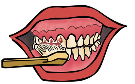 牙齦炎的危害有哪些？