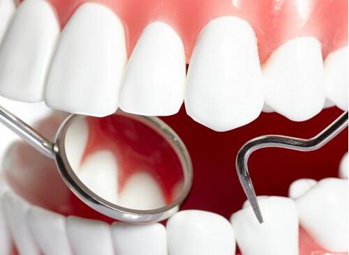 拔智齒一般多少錢？在拔完智齒后應該注意些什