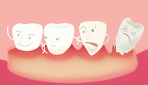 牙齒有一小塊白白的東西到底是什麼？
