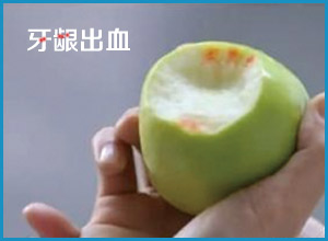 牙齦腫痛出血，吃藥有用么？