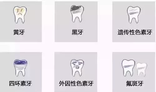 那些在美容院美牙的人，後來怎麼樣了？