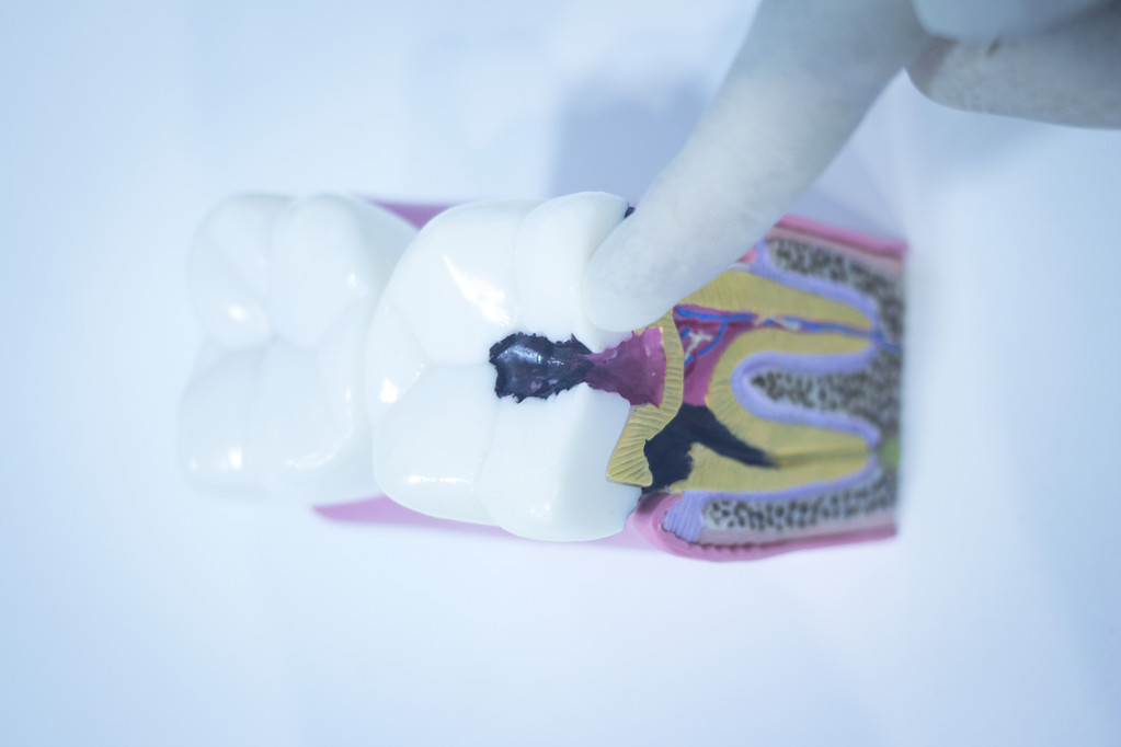 一吃東西牙齒就酸軟 當心5種牙病找上你！