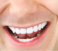 種牙優勢有邊D呢？種牙后又點護理呢？