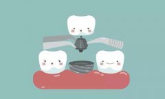 種牙嘅危害有邊D呢？