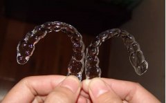 相對於傳統箍牙，隱形箍牙優點有什麽呢？