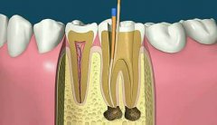 邊D病症適合用杜牙根呢？