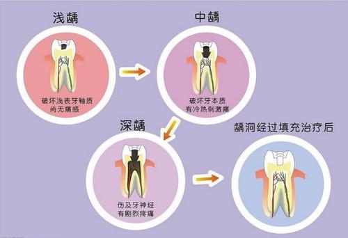 杜牙根嘅詳細介紹