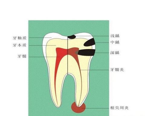 珠海杜牙根