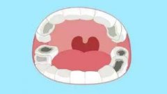 杜牙根嘅成功率有幾多