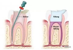 你知道杜牙根嘅優點嗎