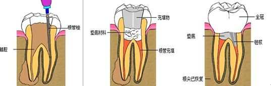 杜牙根痛嗎