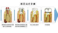 咩時候做杜牙根比較好