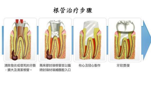 咩時候做杜牙根比較好