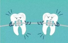 常規箍牙方式有幾種？