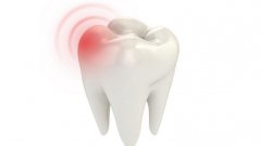 牙周炎成因有哪些方面？