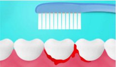 牙齦突然出血係不係很危險？