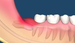 上北mok智慧齒嘅經歷