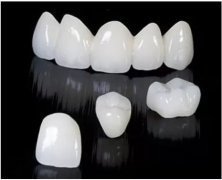 珠海一顆烤瓷牙幾多錢？