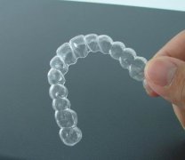 矯正牙齒要拔牙嗎