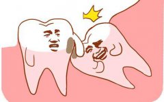 珠海拔一顆智齒的價格需要幾多