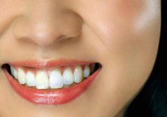 珠海安裝假牙乜時間好?