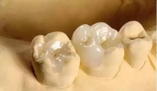 補牙後牙痛嘅治療方式