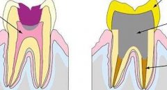 珠海香洲區杜牙根收費幾多呢？