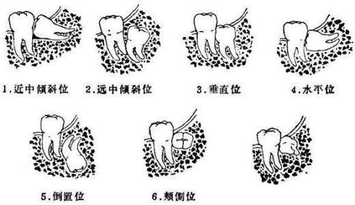 大陸拔智慧齒邊度好