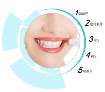 喺大陸做皓齒美白牙齒要幾多錢啊？