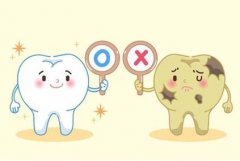 有四環素牙點算啊？