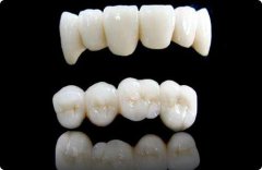 喺珠海做全瓷牙要幾多錢？