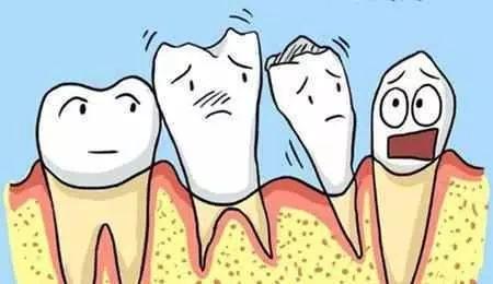 牙周炎症狀