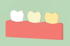 有黃牙點算啊？