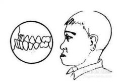 地包天的危害有邊D呢？