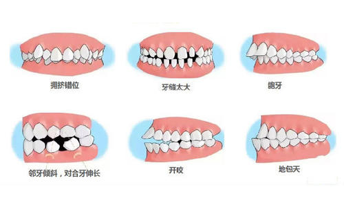 牙齒唔齊危害