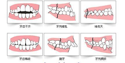 牙齒咬合唔齊危害