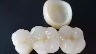 牙冠類型