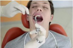 如何預防拔牙後出現幹槽症？