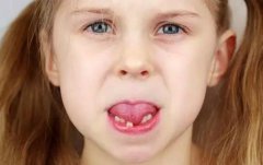 孩子口腔不良習慣危害大