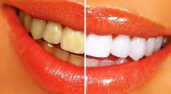 同牙黃講拜拜——來自一位患者心聲