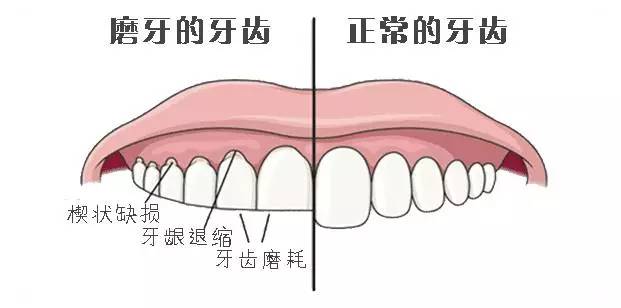 夜磨牙原因