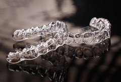 隱形矯正的種類有邊D？