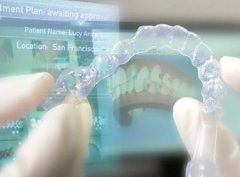 隱形牙齒矯正優點有邊D？