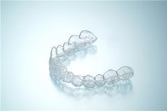 隱形矯正讓你擺脫牙齒不齊的困擾